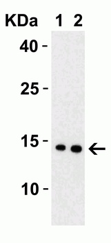 SARS-CoV-2 (COVID-19) Membrane Antibody