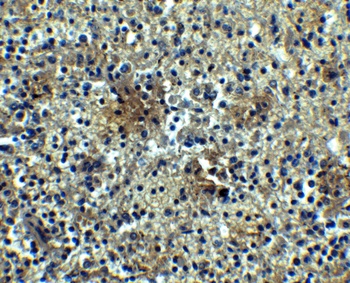 BAFF Receptor Antibody