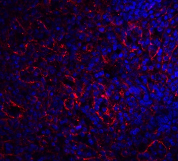 BAFF Receptor Antibody