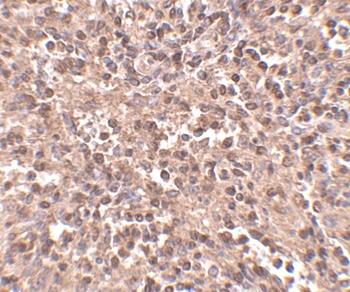 ATG5 Antibody