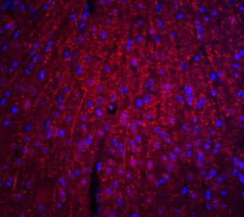 ARID1A Antibody