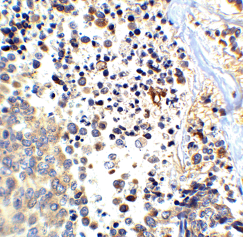 APP Antibody