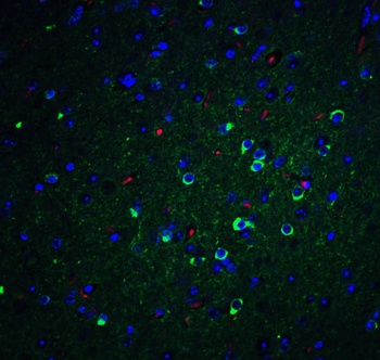 APO-E Antibody