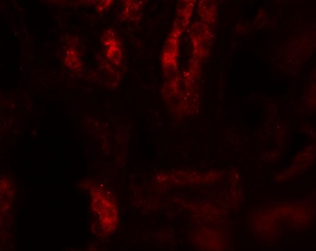 SARM1 Antibody