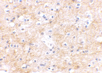 SAPAP3 Antibody