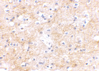 DLGAP3 Antibody