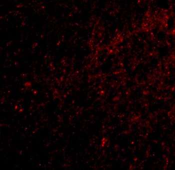 SAPAP3 Antibody