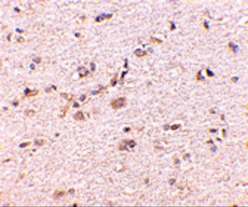 DLGAP1 Antibody