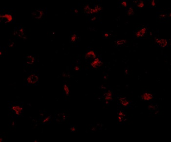 SAPAP1 Antibody