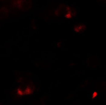 SAMSN1 Antibody