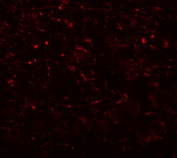 AP3B2 Antibody