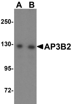 AP3B2 Antibody