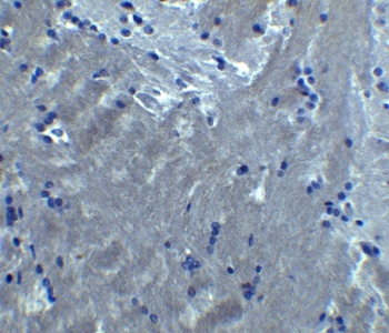 S1PR2 Antibody