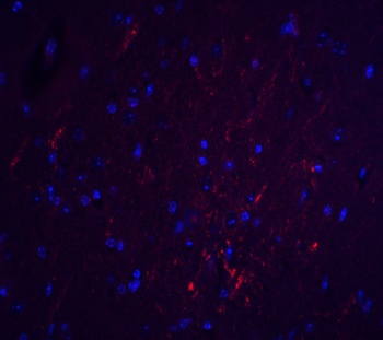 S1PR2 Antibody