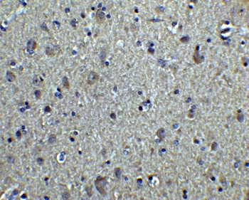TUBA1A Antibody