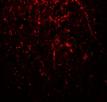 TUBA1A Antibody