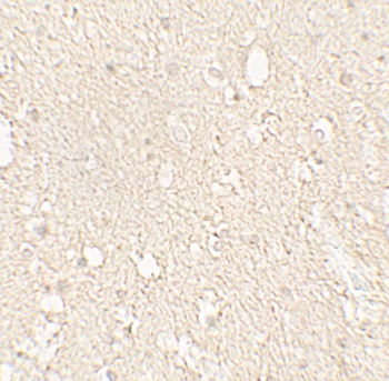 TUBA1A Antibody