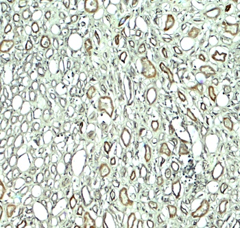 KIAA0226 Antibody