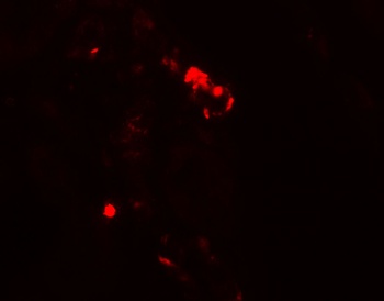 KIAA0226 Antibody