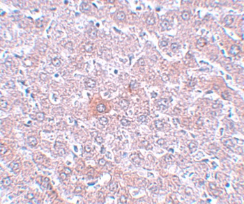 RSRC1 Antibody