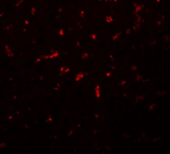RSRC1 Antibody