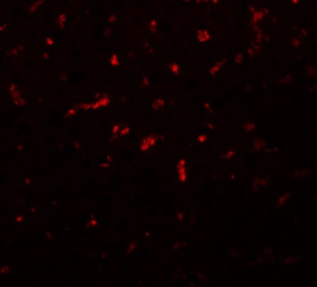 RSRC1 Antibody