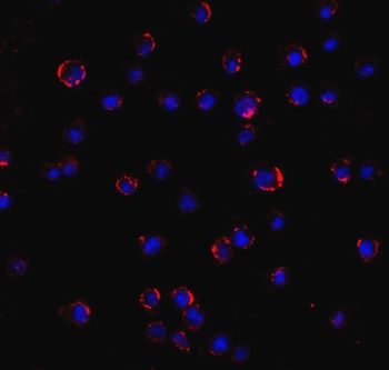 AGTR2 Antibody