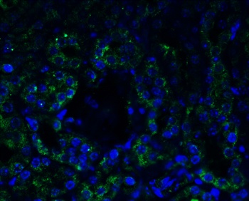 AGTR1 Antibody