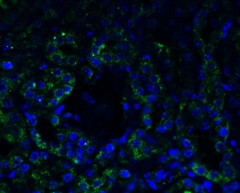 AGTR1 Antibody