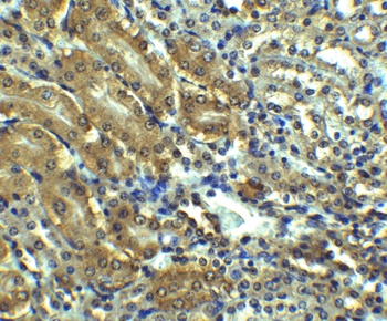 AGTR1 Antibody