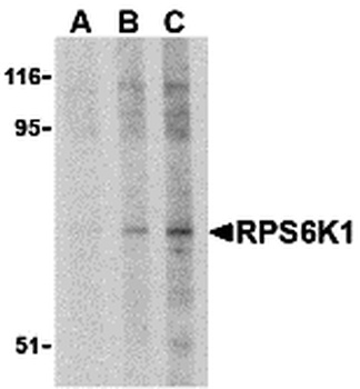 RPS6KA1 Antibody