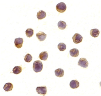 RPS6KA1 Antibody
