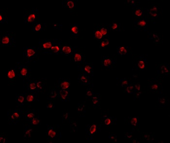 RPS6KA1 Antibody