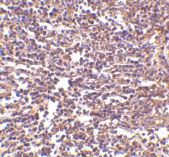 CD180 Antibody