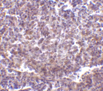 CD180 Antibody