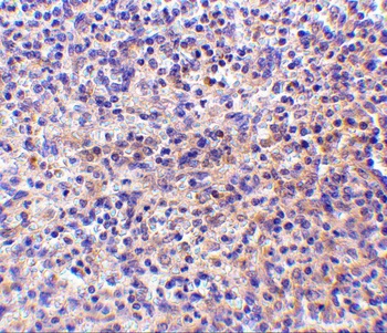 CD180 Antibody