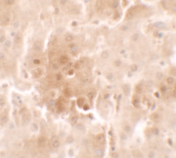 RNF20 Antibody