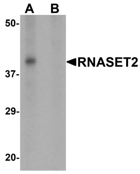 RNASET2 Antibody