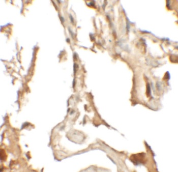 RLP2 Antibody