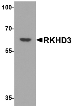 RKHD3 Antibody