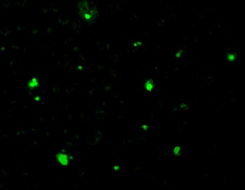 ACIN1 Antibody