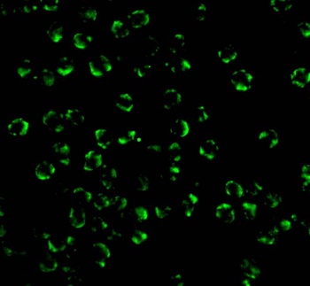 RICK Antibody