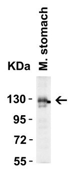 ACE2 Antibody