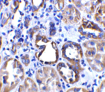 ACE2 Antibody