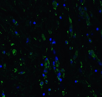 ACE2 Antibody