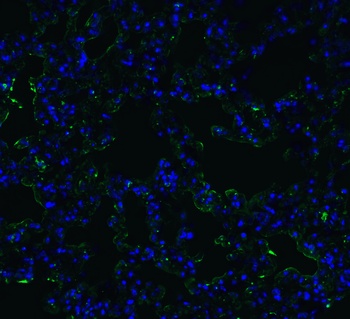 ACE2 Antibody