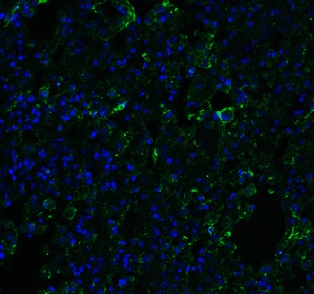 ACE2 Antibody