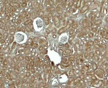 RHOG Antibody