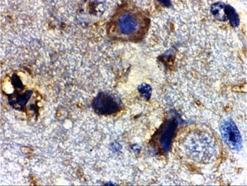 Rheb Antibody