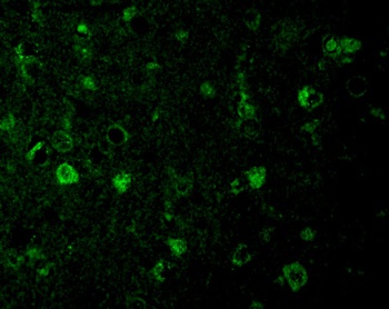 Rheb Antibody